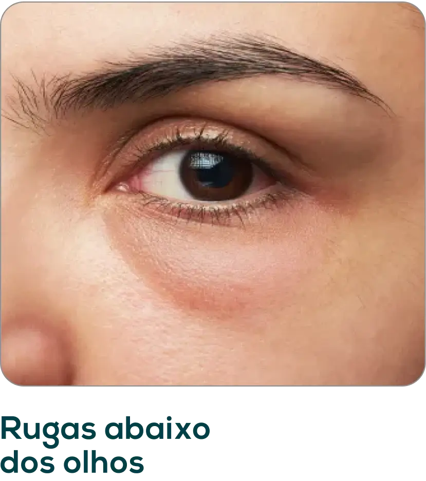 Frame-1171275397.webp