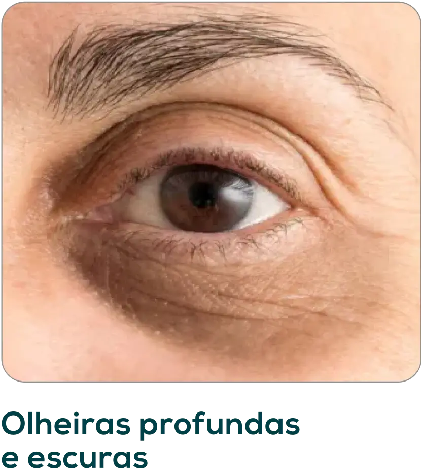 Frame-1171275398.webp