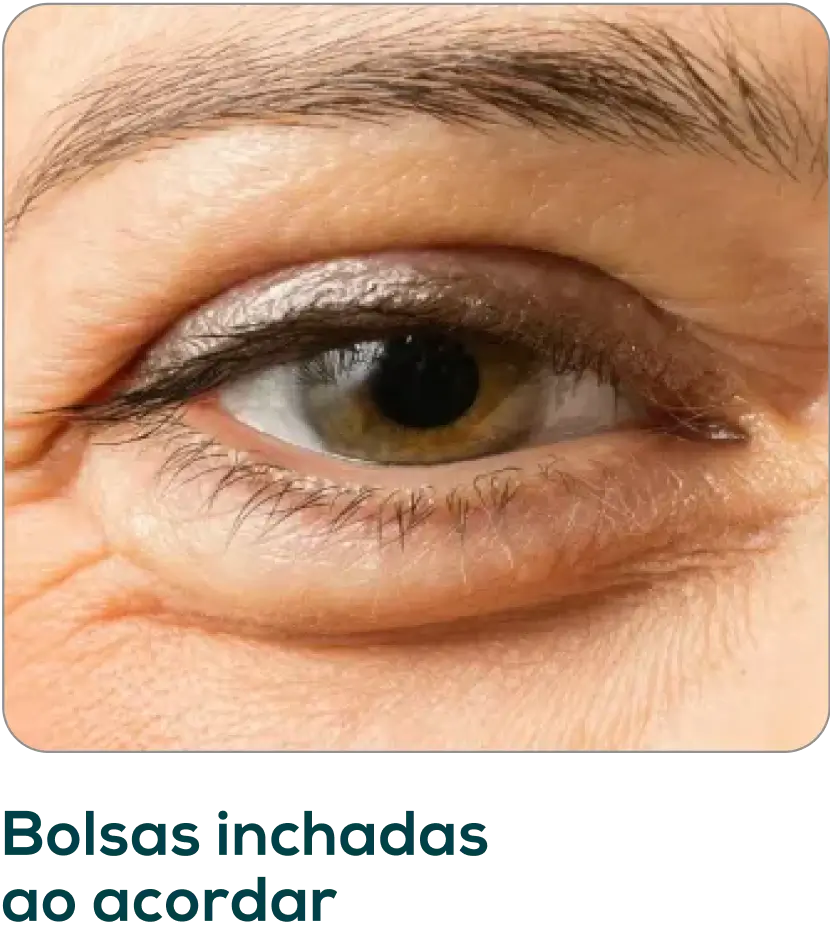 Frame-1171275399.webp