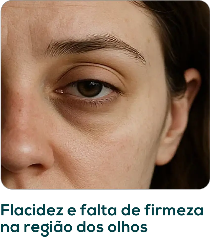 Frame-1171275401.webp