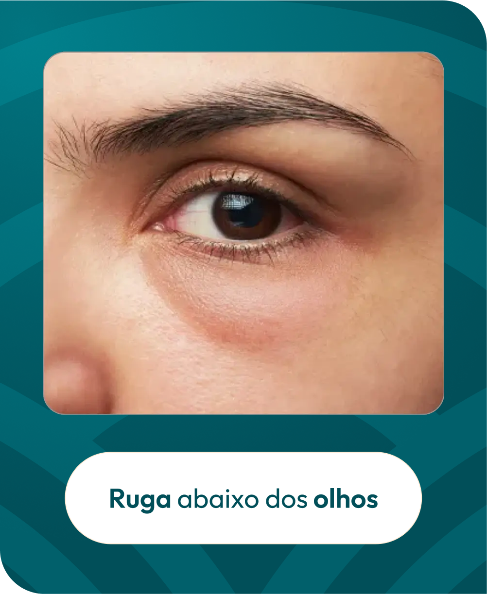 FOTO1.png