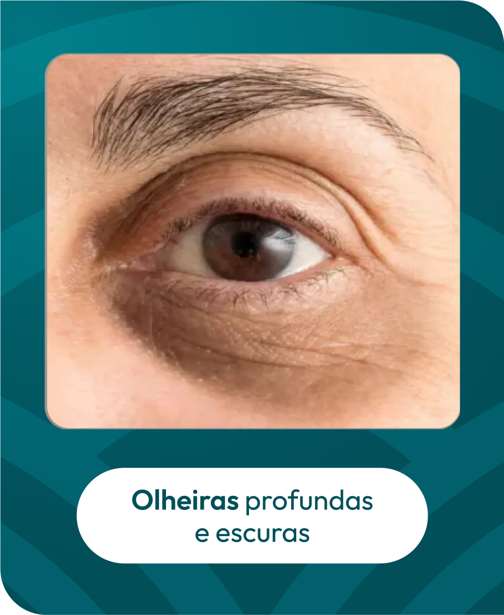 FOTO2.png